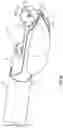 Fig. 27 - Excisional devices and methods