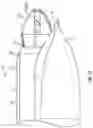 Fig. 28 - Excisional devices and methods