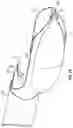 Fig. 30 - Excisional devices and methods