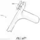 Fig. 16 - VASCULAR ACCESS DEVICE