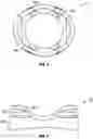 Fig. 04 - Orthopedic fixation devices and methods of installation thereof