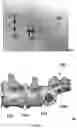 Fig. 09 - Apparatus and method for minimally invasive osteosynthesis of sacroiliac luxations/fractures