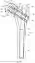 Fig. 22 - INTRAMEDULLARY ROD WITH PIVOTABLE FASTENER AND METHOD FOR USING SAME