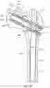 Fig. 24 - INTRAMEDULLARY ROD WITH PIVOTABLE FASTENER AND METHOD FOR USING SAME