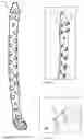 Fig. 06 - Femur plate
