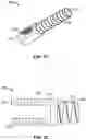 Fig. 23 - Bone fusion system