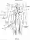 Fig. 03 - Catheter assemblies comprising a direct heating element for renal neuromodulation and associated systems and methods