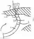 Fig. 07 - System and method for controlling catheter power based on contact force