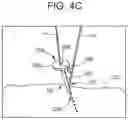 Fig. 07 - Systems, devices, and methods for providing surgical trajectory guidance