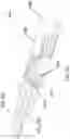 Fig. 07 - Articulating surgical instrument