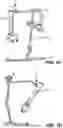 Fig. 03 - Releasable attachment device for coupling to medical devices and related systems and methods