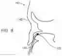 Fig. 08 - Medical instrument identification