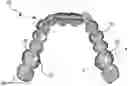 Fig. 01 - Systems and methods for making an orthodontic aligner