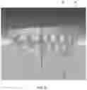 Fig. 07 - Systems and methods for making an orthodontic aligner