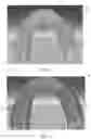 Fig. 08 - Systems and methods for making an orthodontic aligner