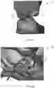Fig. 09 - Systems and methods for making an orthodontic aligner