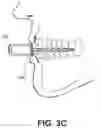 Fig. 05 - VARIABLE-FREQUENCY ORAL VIBRATION SYSTEMS AND METHODS