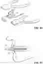 Fig. 09 - VARIABLE-FREQUENCY ORAL VIBRATION SYSTEMS AND METHODS