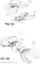 Fig. 16 - VARIABLE-FREQUENCY ORAL VIBRATION SYSTEMS AND METHODS