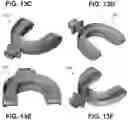 Fig. 18 - VARIABLE-FREQUENCY ORAL VIBRATION SYSTEMS AND METHODS