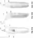 Fig. 33 - VARIABLE-FREQUENCY ORAL VIBRATION SYSTEMS AND METHODS