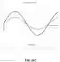 Fig. 37 - VARIABLE-FREQUENCY ORAL VIBRATION SYSTEMS AND METHODS