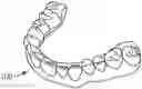 Fig. 01 - Orthodontic appliance having continuous shape memory