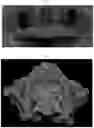Fig. 02 - Three-dimensional printed bone supported sinus guide for edentulous maxillary arch