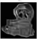 Fig. 03 - Three-dimensional printed bone supported sinus guide for edentulous maxillary arch