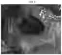 Fig. 05 - Three-dimensional printed bone supported sinus guide for edentulous maxillary arch