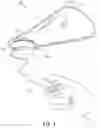 Fig. 02 - Device for the delivery of a prosthetic implant and method of use thereof
