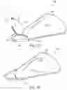 Fig. 03 - Device for the delivery of a prosthetic implant and method of use thereof