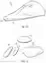 Fig. 04 - Device for the delivery of a prosthetic implant and method of use thereof