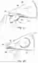 Fig. 07 - Device for the delivery of a prosthetic implant and method of use thereof