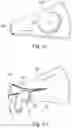 Fig. 08 - Device for the delivery of a prosthetic implant and method of use thereof