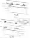 Fig. 09 - DEVICE AND METHOD FOR DEPLOYING AND ATTACHING AN IMPLANT TO A BIOLOGICAL TISSUE