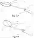 Fig. 36 - DEVICE AND METHOD FOR DEPLOYING AND ATTACHING AN IMPLANT TO A BIOLOGICAL TISSUE