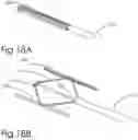 Fig. 40 - DEVICE AND METHOD FOR DEPLOYING AND ATTACHING AN IMPLANT TO A BIOLOGICAL TISSUE