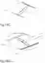 Fig. 41 - DEVICE AND METHOD FOR DEPLOYING AND ATTACHING AN IMPLANT TO A BIOLOGICAL TISSUE