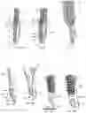 Fig. 10 - Fixation member with separate eyelet and methods of use thereof