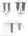 Fig. 15 - Fixation member with separate eyelet and methods of use thereof