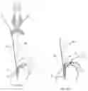 Fig. 17 - Fixation member with separate eyelet and methods of use thereof