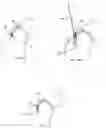 Fig. 19 - Fixation member with separate eyelet and methods of use thereof