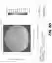 Fig. 09 - Systems and methods for spectacle independence using refractive index writing with an intraocular lens