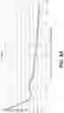 Fig. 12 - Systems and methods for spectacle independence using refractive index writing with an intraocular lens
