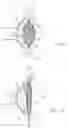Fig. 02 - Hybrid accommodating intraocular lens assemblages