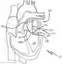 Fig. 01 - METHOD OF IMPLANTING VALVE PROSTHESIS HAVING ATRIAL ANCHORING