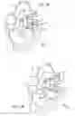 Fig. 04 - METHOD OF IMPLANTING VALVE PROSTHESIS HAVING ATRIAL ANCHORING