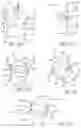 Fig. 11 - METHOD OF IMPLANTING VALVE PROSTHESIS HAVING ATRIAL ANCHORING