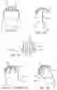 Fig. 13 - METHOD OF IMPLANTING VALVE PROSTHESIS HAVING ATRIAL ANCHORING